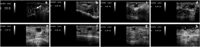 Plasma IGF1 and 17β-Estradiol Concentrations During the Follicular Wave in Llamas